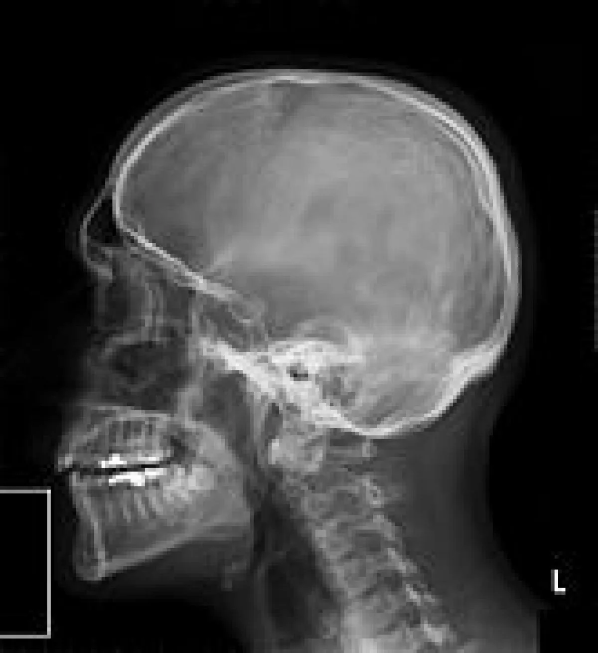 Nawet 80 % rozpoznań w medycynie stawianych jest na podstawie obrazów radiologicznych 