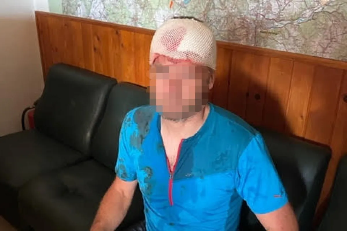 Atak niedźwiedzia na Słowacji, poszkodowany trafił do szpitala z obrażeniami głowy