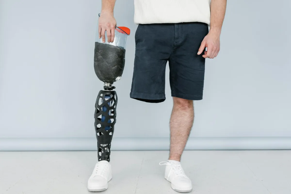 „Ból, którego nie ma” – o wykorzystaniu sztucznej inteligencji w rehabilitacji po amputacjach