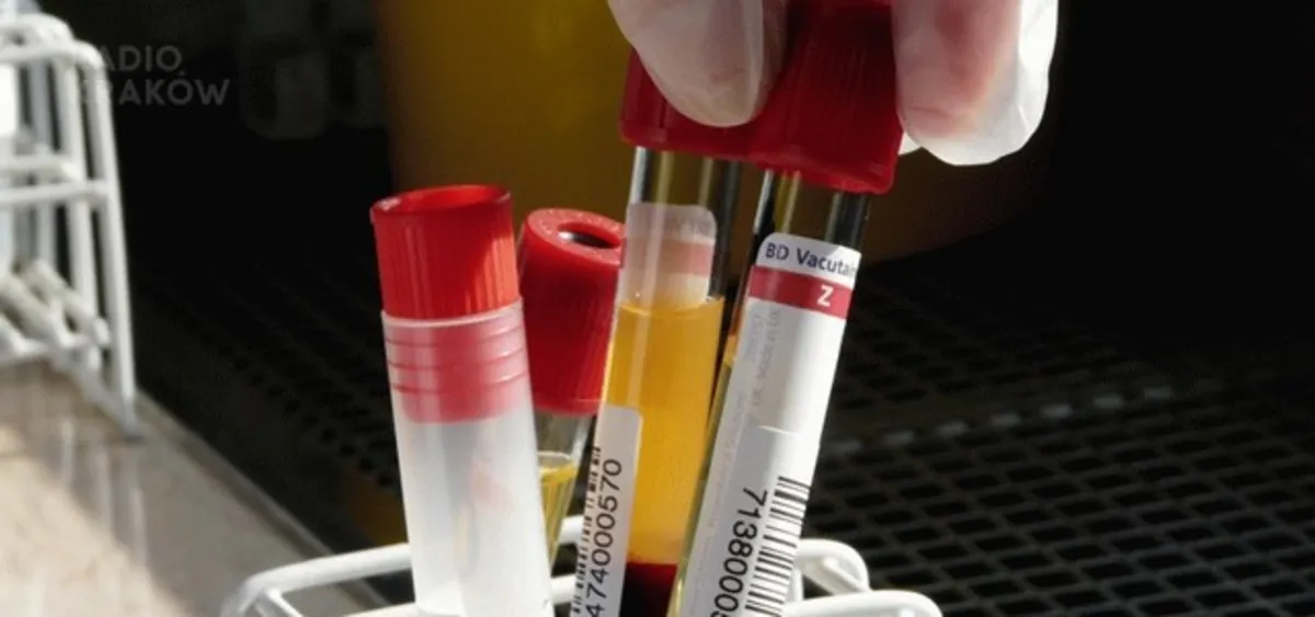 Tarnów: Ruszyły bezpłatne testy na HIV