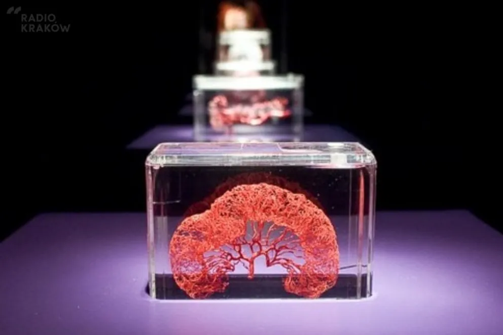 "The Human Body Exhibition" w Krakowie/ fot. Materiały prasowe
