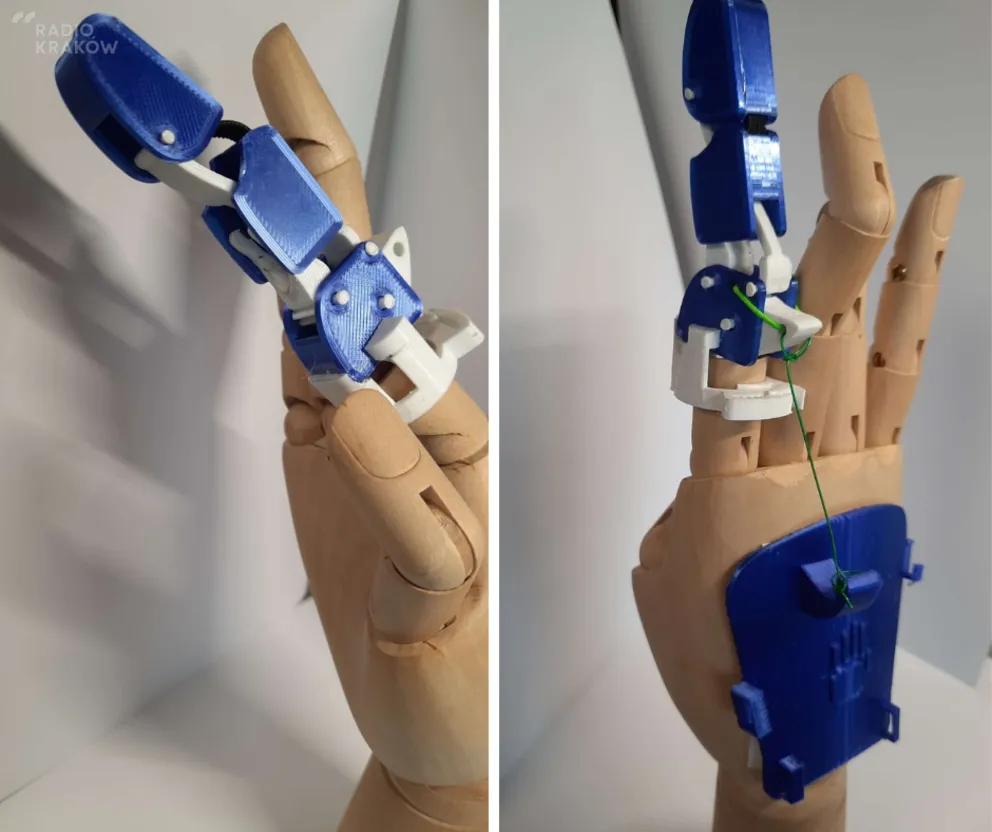 Studenci AGH opracowali biomechaniczną protezę palców dłoni