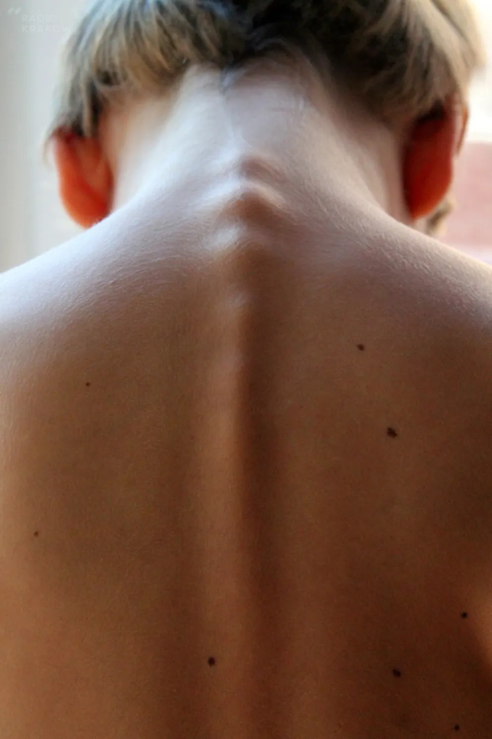 Osteoporoza - choroba wieku podeszłego?
