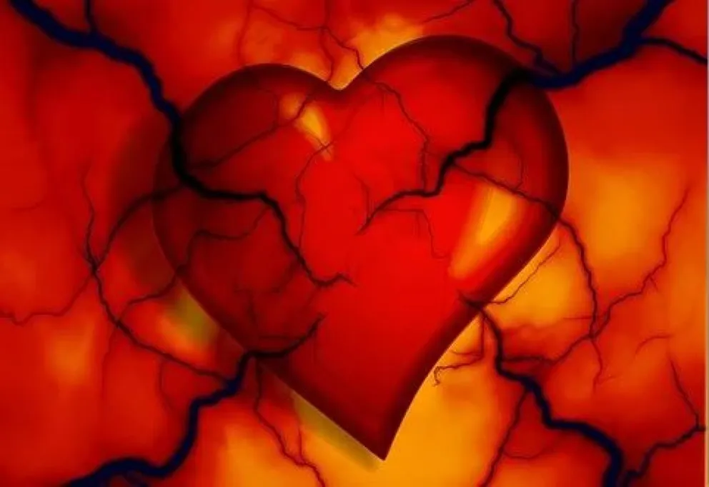 Hipercholesterolemia 