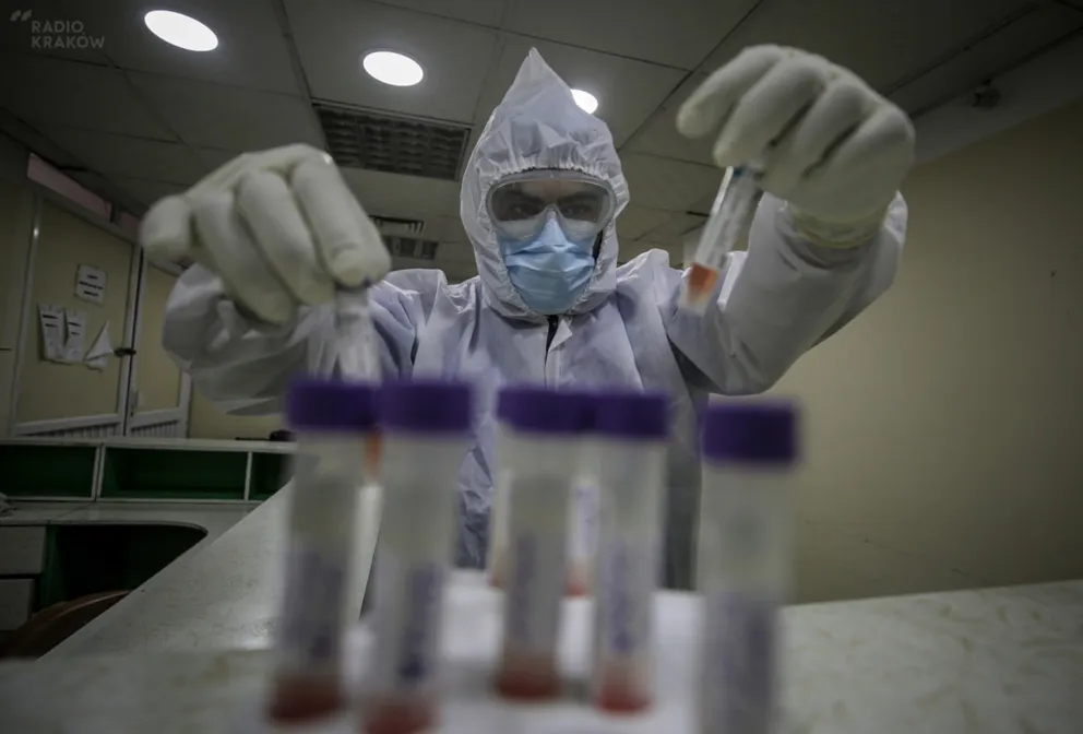 "Nowy sposób przedstawiania statystyk COVID-19 daje pełniejszy obraz epidemii"