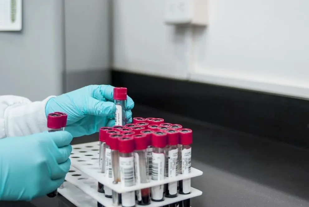 Hipercholesterolemia rodzinna - niebezpieczna dla zdrowia i życia