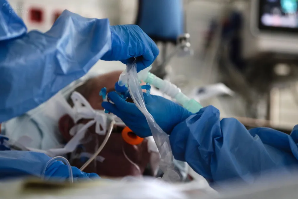 2072 łóżka i 209 respiratorów zajętych przez pacjentów z COVID-19 w Małopolsce