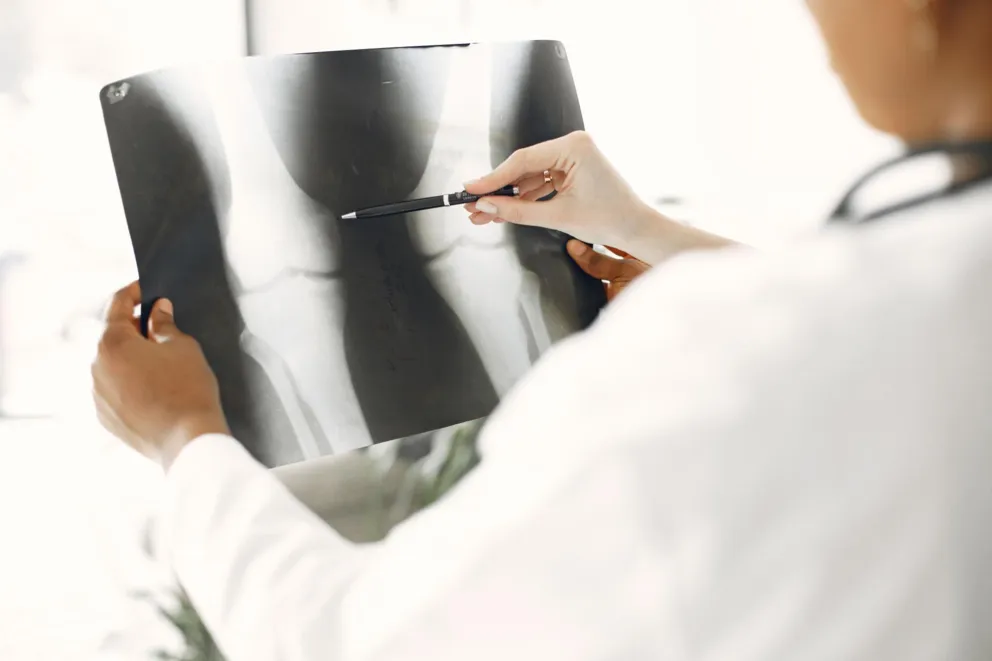 Osteoporoza nie dotyczy tylko seniorów. "Ruch może zastąpić każdy lek"